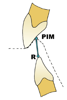 Analyse de l'occlusion Module 1