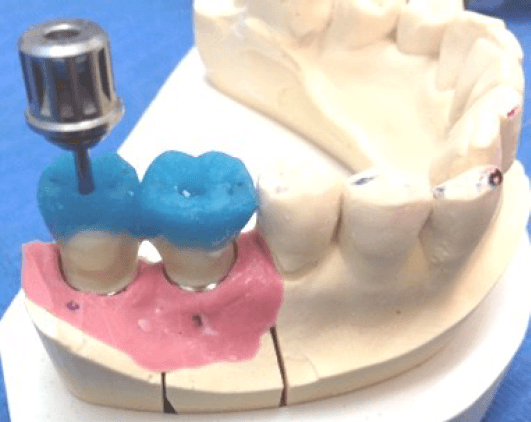 Formation Module 3 - Dysfonctions cranio-mandibulaires