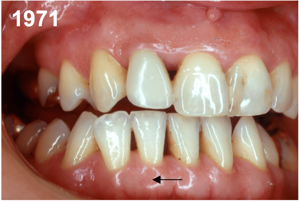 Formation Module 3 - Numérique en occlusodontie